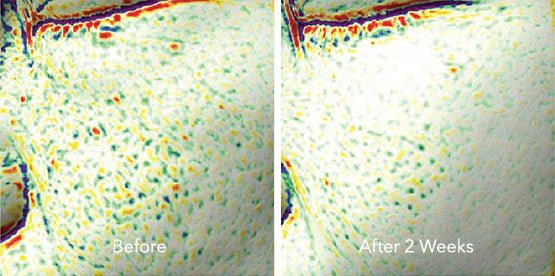 REJURAN Turnover Ampoule 0.5% cPDRN - RIMAN KBeauty - Korean Skincare Routine for Glass Skin