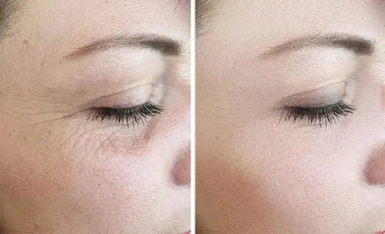 REJURAN Turnover Mask PDRN 1box 5ct. - RIMAN KBeauty - Korean Skincare Routine for Glass Skin